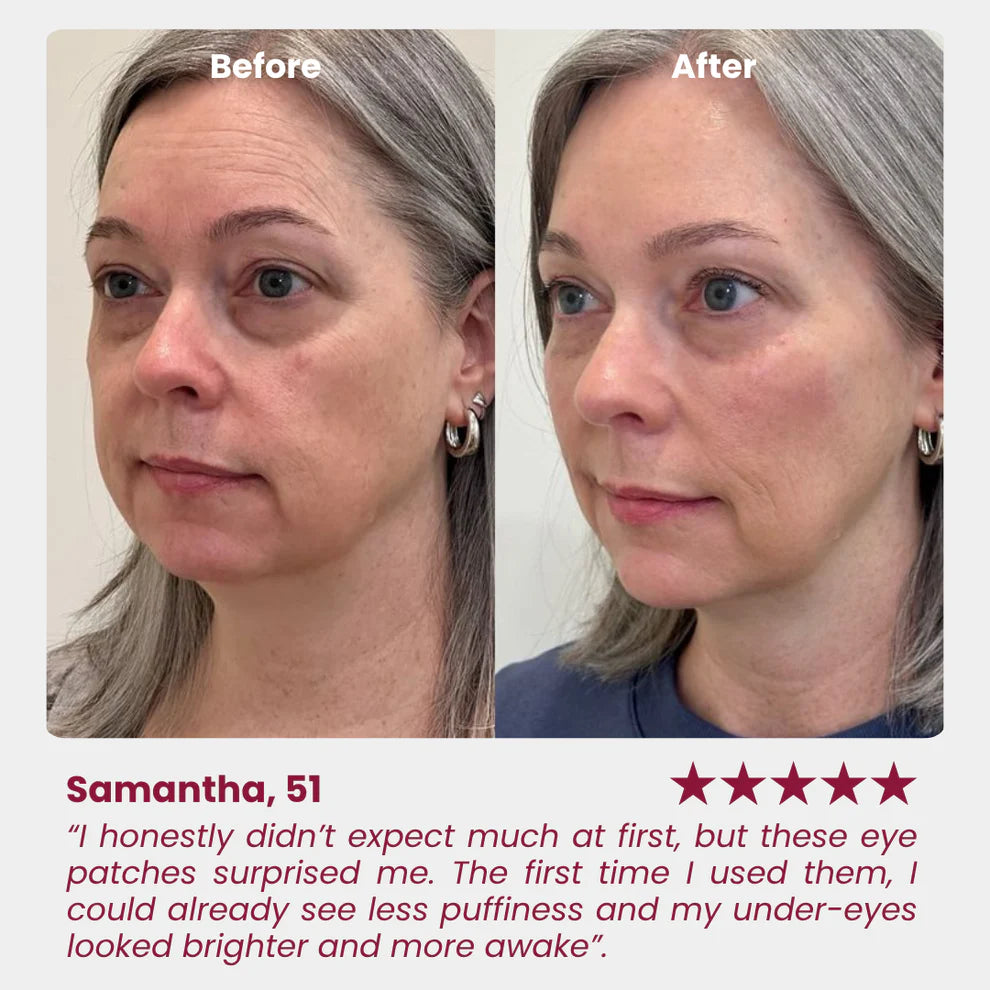 Noveri™ Collagen Hydrogel Eye Patches